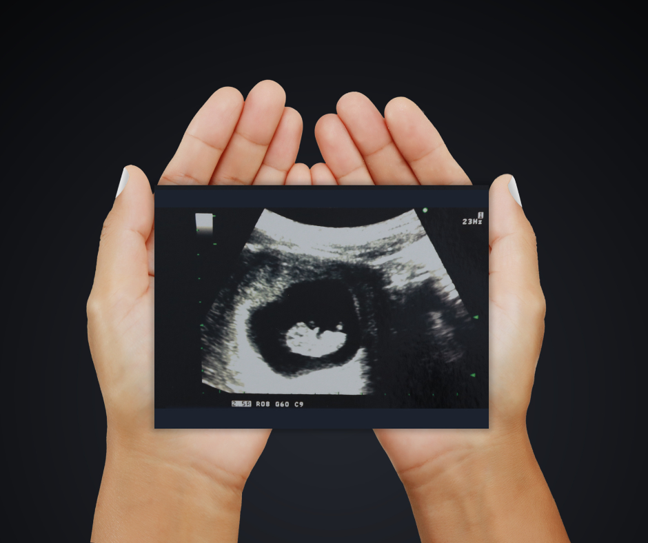 Choosing life. An ultrasound image.